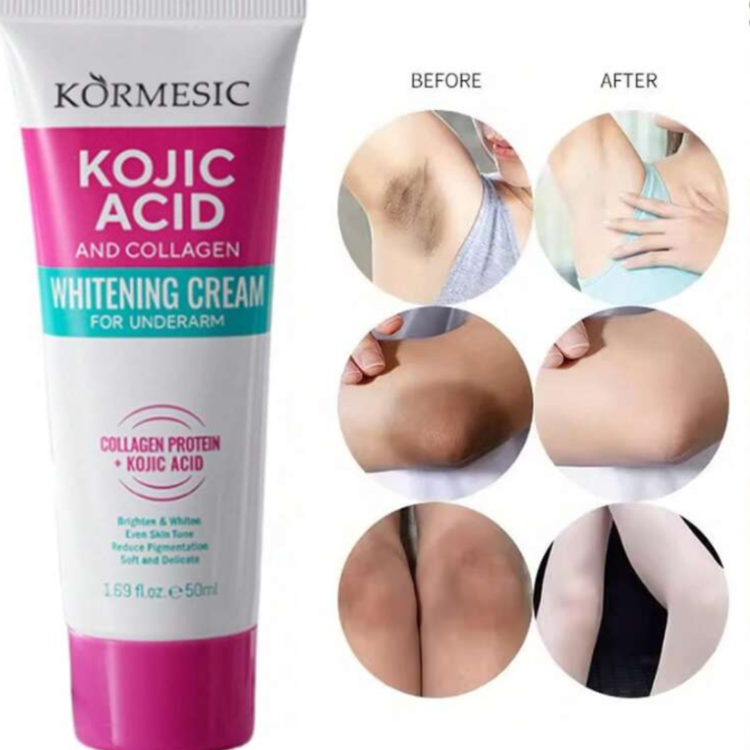 Kormesic Kojic Acid & Collagen Whitening Cream – Underarm Brightening (50ml)